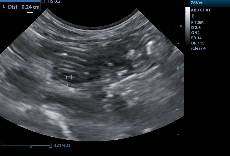 Échographie abdominale : mesure ciblée