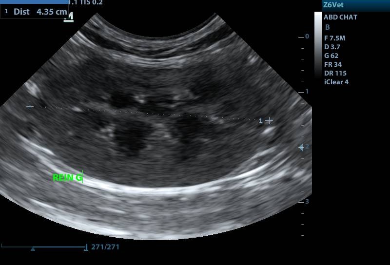 Échographie abdominale : mesure rénale