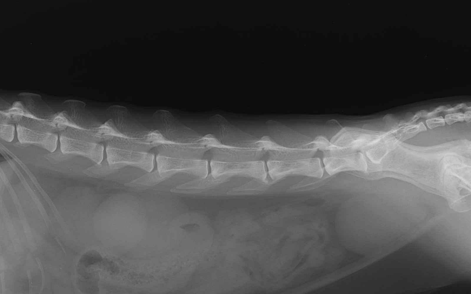 Radiographie de profil : abdomen et rachis