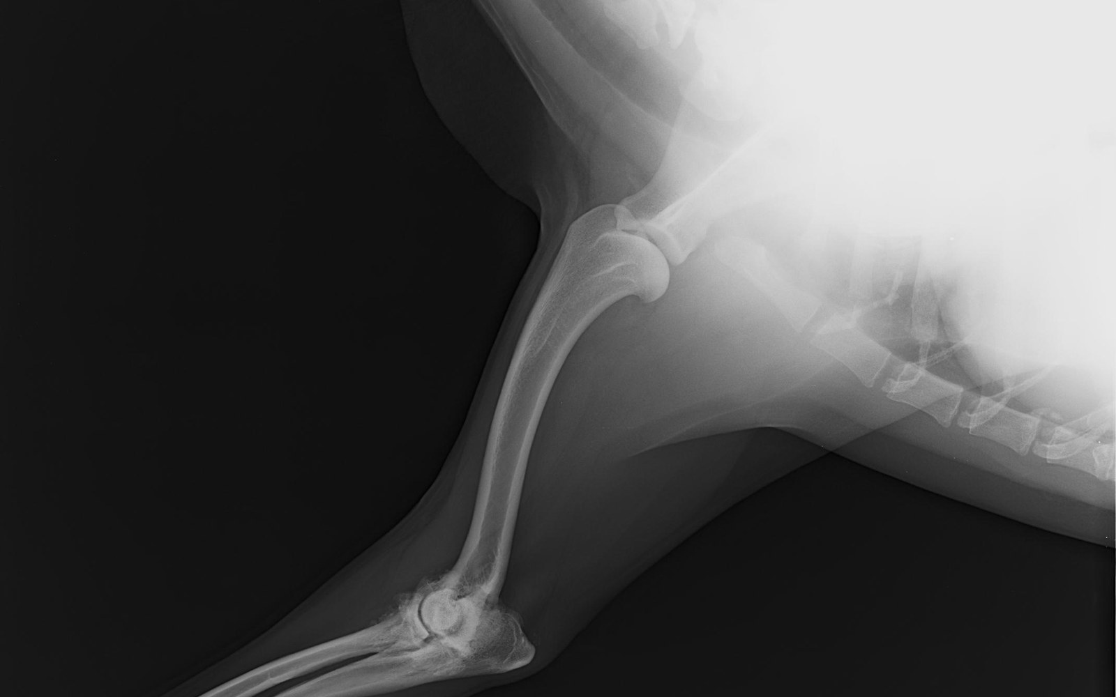 Radiographie du genou