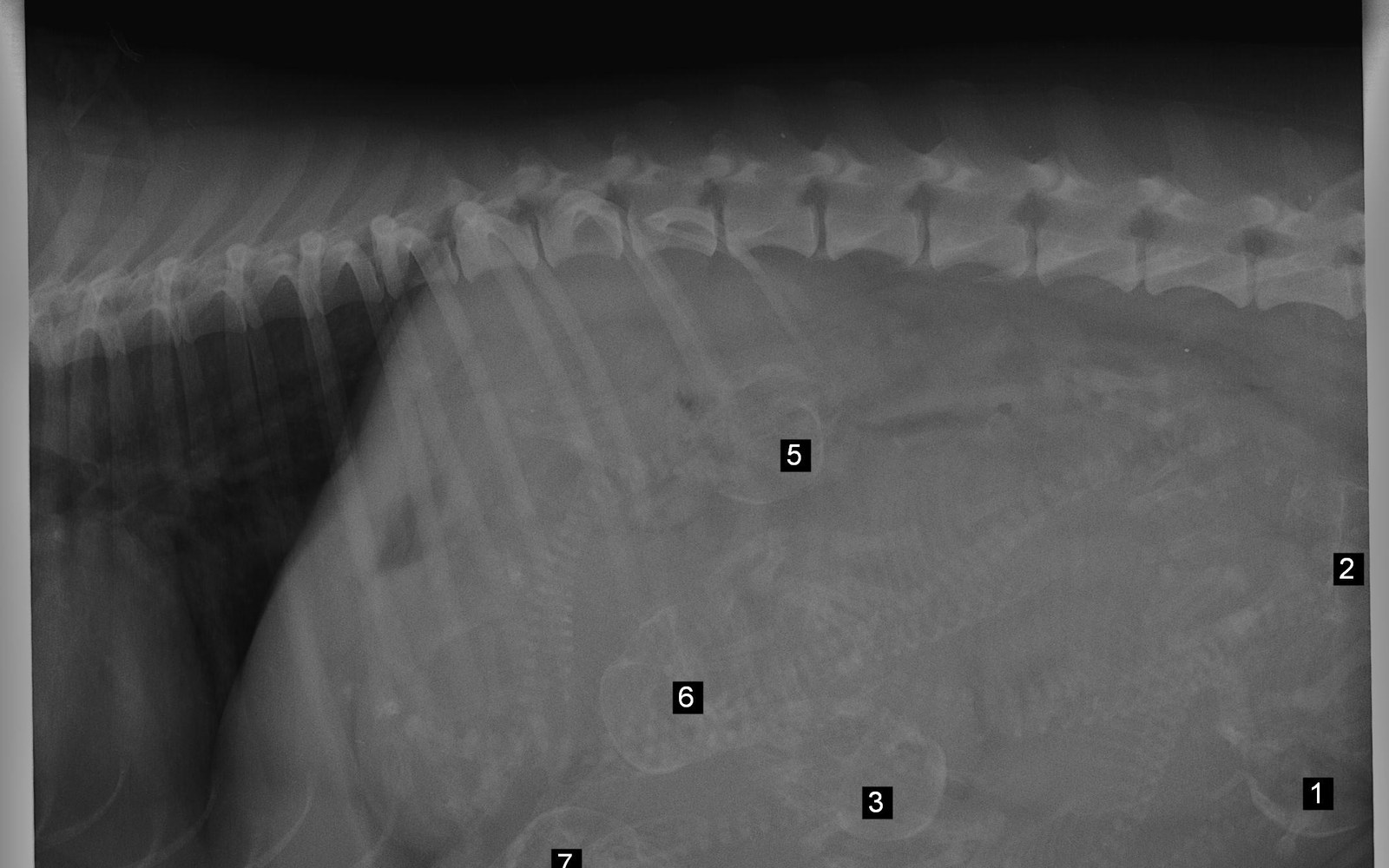 Radiographie : gestation, fœtus numérotés